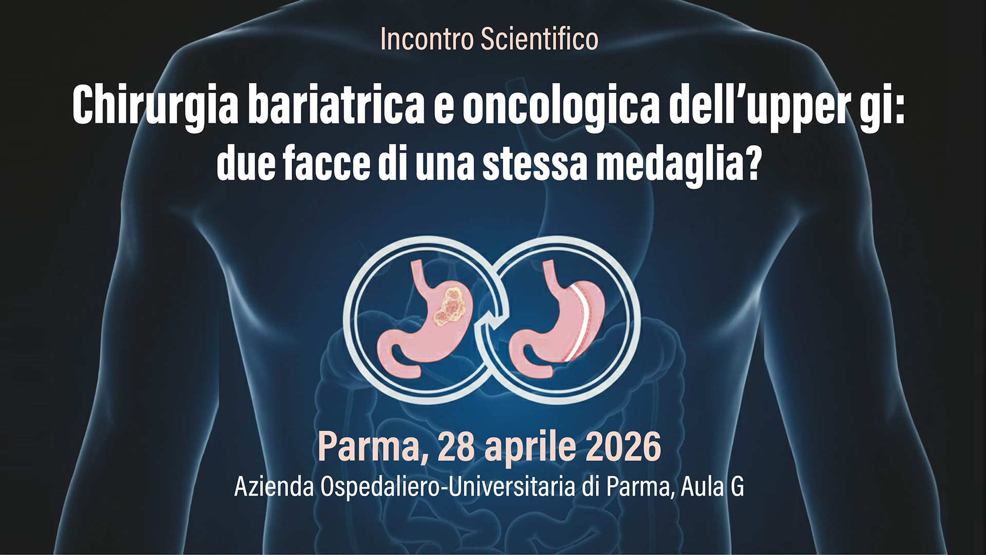 Chirurgia bariatrica  e oncologica dell’upper gi: due facce di una stessa medaglia?