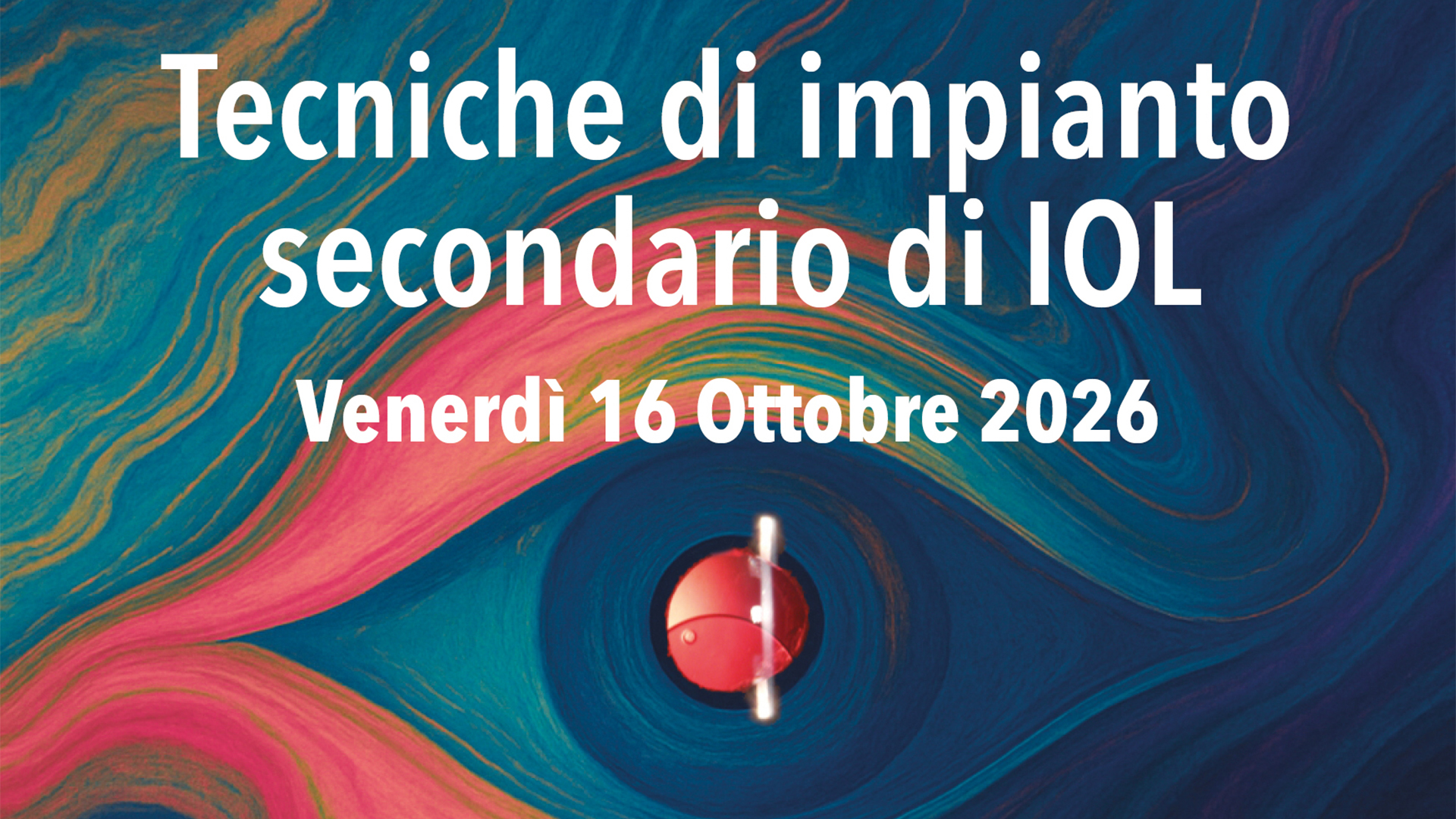 Tecniche di impianto secondario di IOL